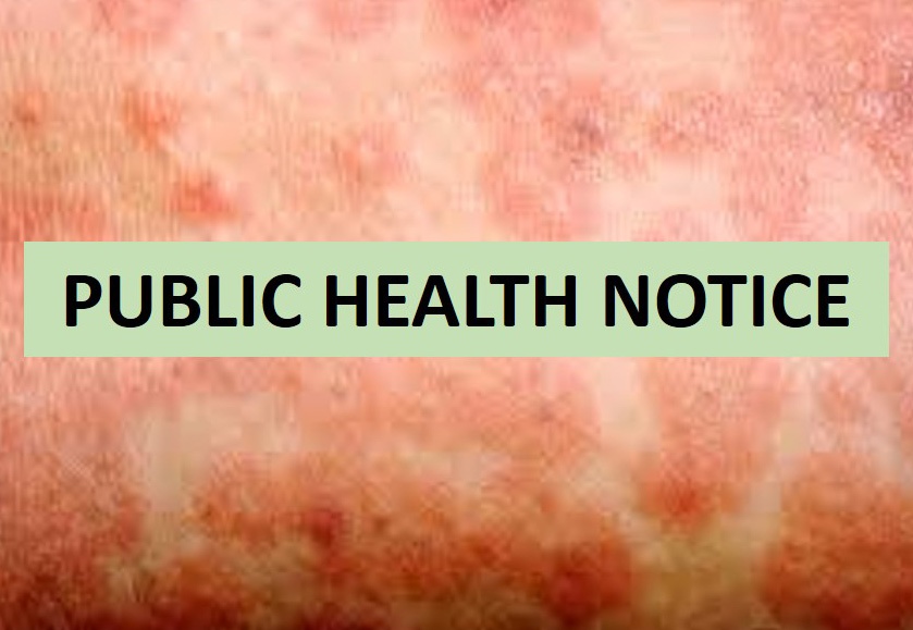 Measles – No Known Potential Exposures in Greene County